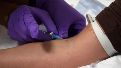 FDA Peptide Panel to Decide if Compounding Pharmacies Can Resume Production