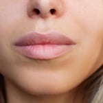 Instagram Face Drives Teen Plastic Surgery Boom, Erasing Human Flaws
