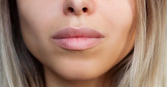 Instagram Face Drives Teen Plastic Surgery Boom, Erasing Human Flaws