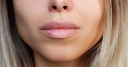 Instagram Face Drives Teen Plastic Surgery Boom, Erasing Human Flaws